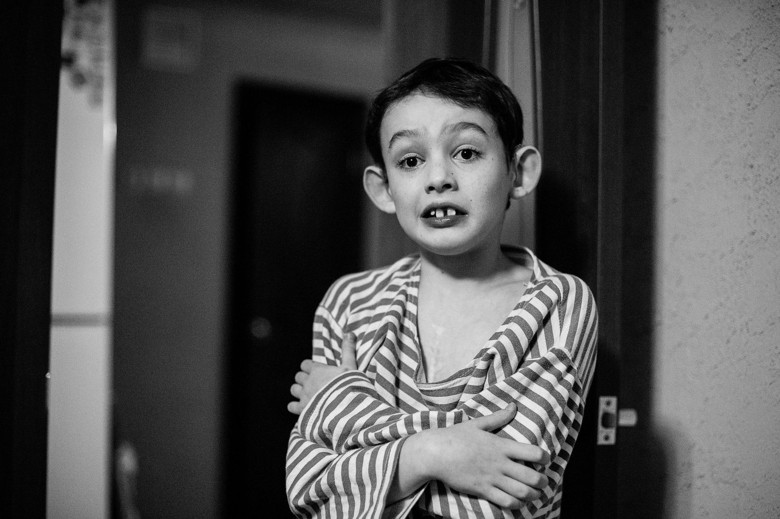 Arik Shraga. Russia. Ural region. Yekaterinburg. Lesha Lesha underwent 4 cardiac surgeries during the first month of his life. After one of the surgeries he was prescripted with strong antibiotics which made him deaf
